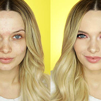 SKIN POSITIVITY: THE LATEST TREND TAKING THE BEAUTY WORLD BY STORM